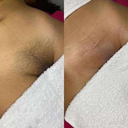 Full Depilation Service to Domicile