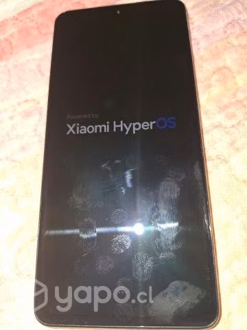 Redmi note 11 pro