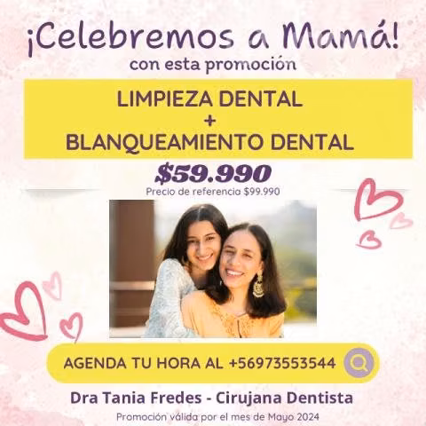 Limpieza + blanqueamiento dental
