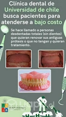 Prótesis dentales totales