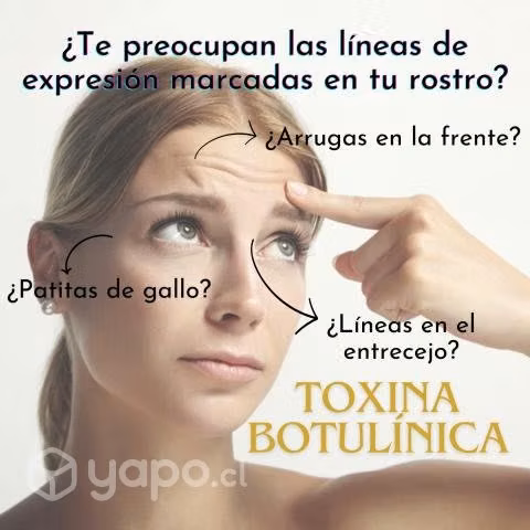 Botox 3 zonas