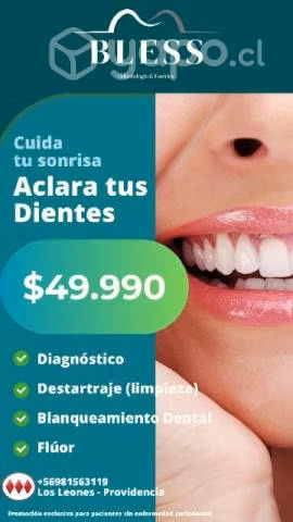 Oferta imperdible blanqueamiento + limpieza dental
