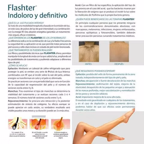 Aparatologia estetica , ipl flashter ,mesoterapia