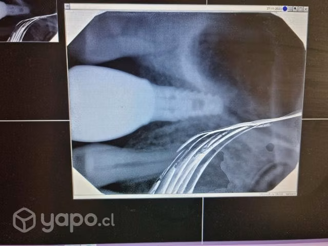 Sensor rayos x dental dexis - Imagen 3