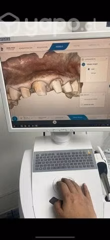 Omnicam Sirona