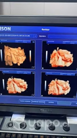 Ecografía Emocional 4D y 5D