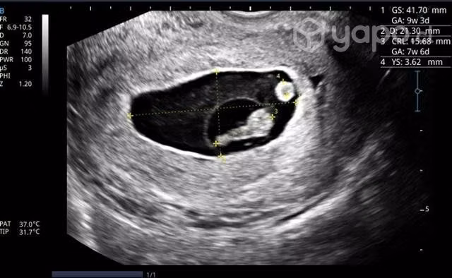 Ecografias obstetricas y ginecológicas
