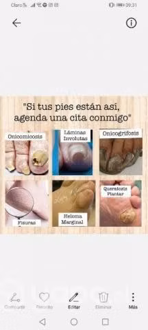 Podología Clínica