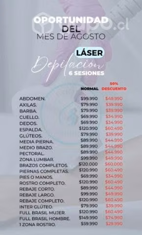 Depilación laser