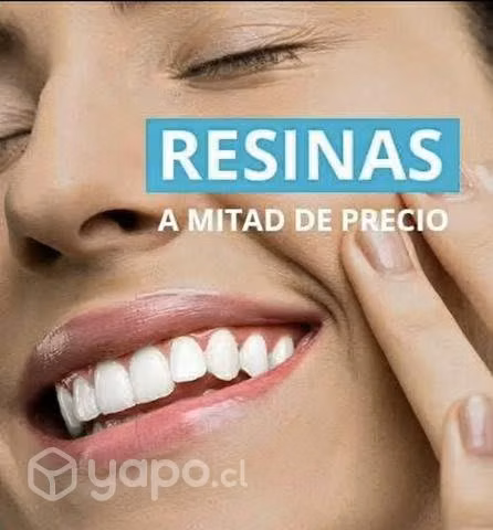 Tapaduras dental