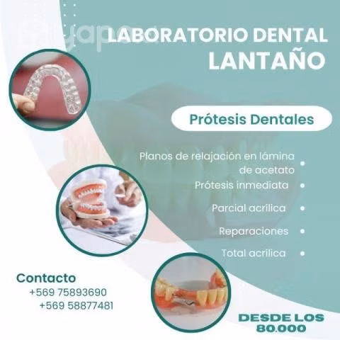 Prótesis dentales