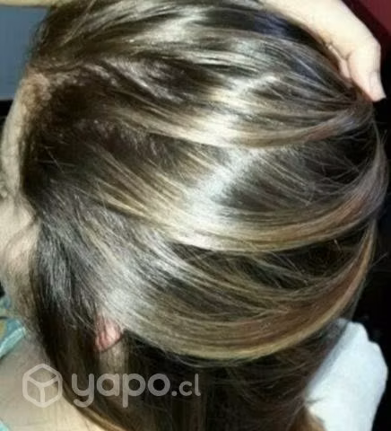 Lizzie photon nuevo - Imagen 2