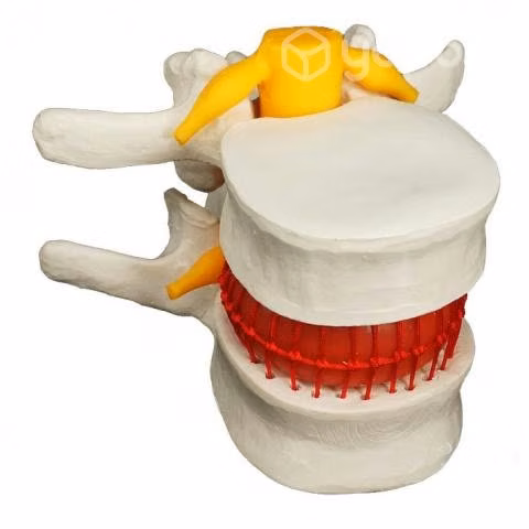 Modelo Anatómico Disco Lumbar Espina Dorsal