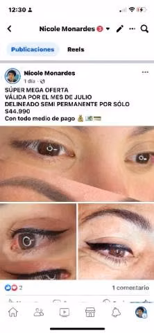Micropigmentación. - Imagen 4
