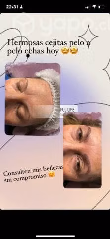 Micropigmentación. - Imagen 5