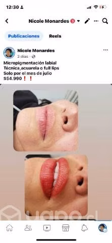 Micropigmentación. - Imagen 2