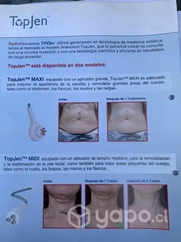 Equipo Radiofrecuencia Tripollar By Pollogen - Imagen 4