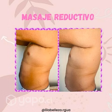 Máquina cavitacion 5 en 1 - Imagen 4