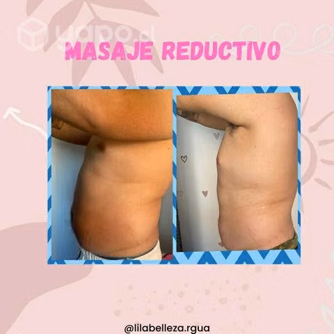Máquina cavitacion 5 en 1 - Imagen 3