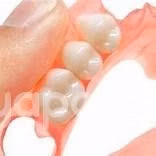 Realizamos a domicilio protesis dentales flexibles