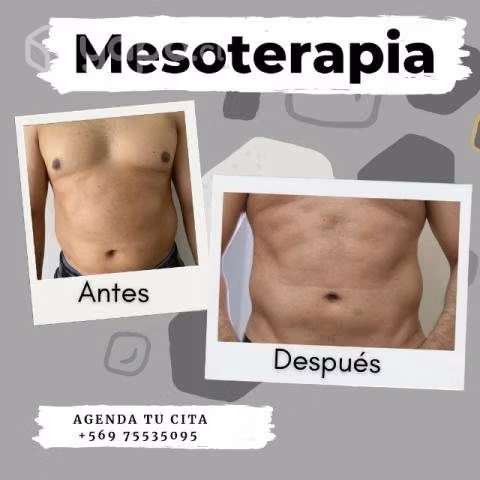 Elimina grasa localizada
