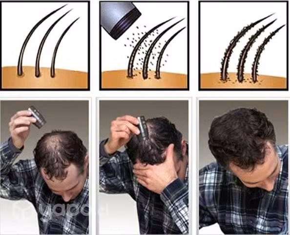 Nano Hair calvicie