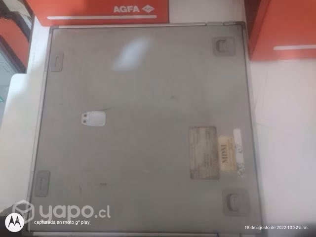 Chasis de columna total para Radiología - Imagen 4