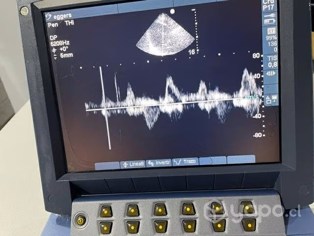 Ecocardiografo SonoSite MicroMaxx - Imagen 2