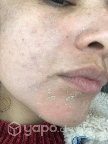 Peeling orgánico