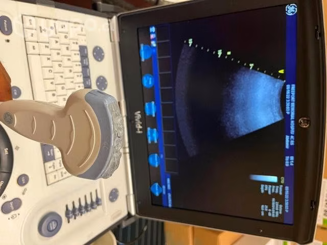 Ge 4c-rs ultrasound transducer - Imagen 3
