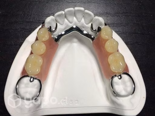 Prótesis Dentales Removibles Maipú