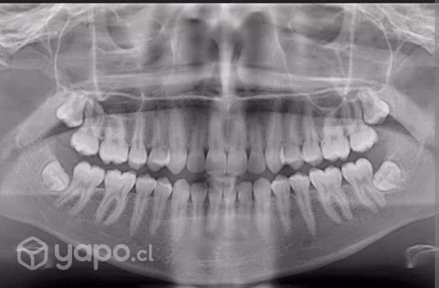 Imagen Panorámica dental a 10 mil pesos
