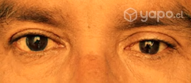 Ojos de acrílico PMMA (prótesis oculares)