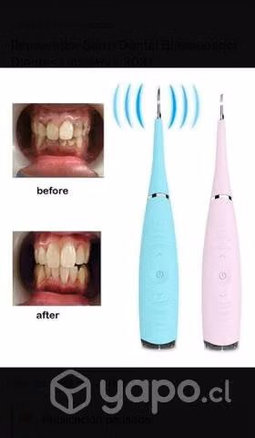 Limpiador dental