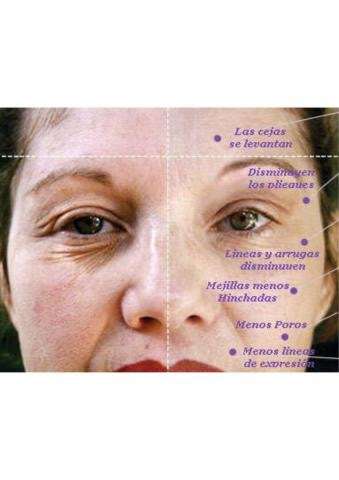 Derma Wand Radiofrecuencia Original - Imagen 3