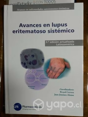 Avances en Lupus Eritematoso