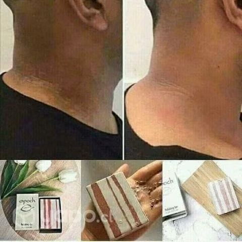 Exfoliación