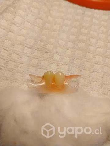 Reparación de prótesis dentales