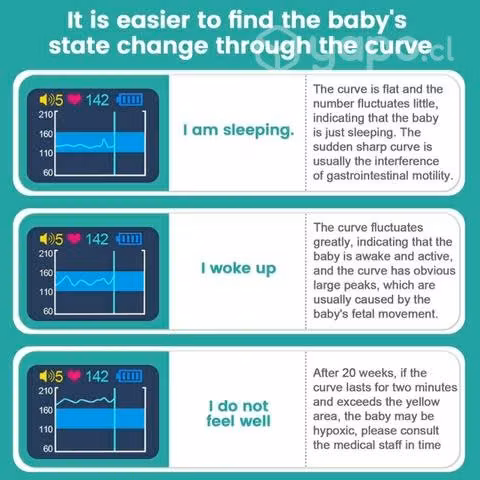 Doppler fetal detector de latidos fetales Embarazo