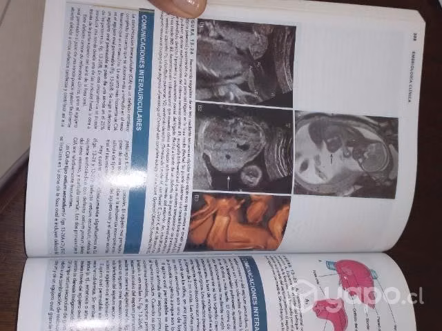 Libro embriología clínica