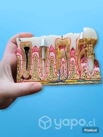 Macromodelo educativo dental
