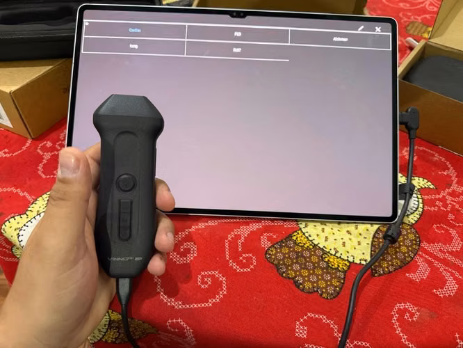 Ultrasonido vinno q plus