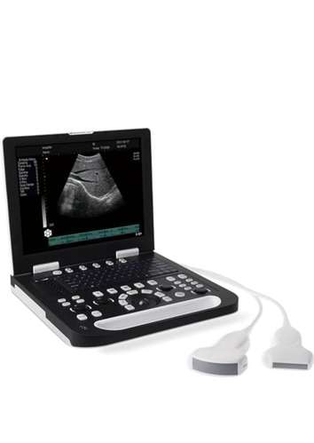 Ultrasound 