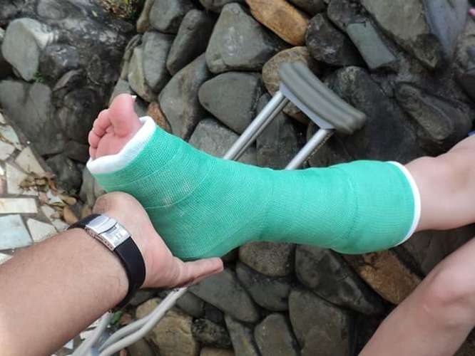 Muletas Botas Ortopédicas Walker Inmovilizador de Rodilla Tobilleras Rodilleras Bastones canadienses vendas de yeso fisioterapia - Imagen 2
