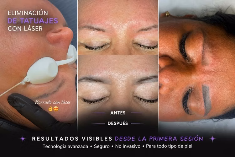 Vendo máquina láser - Imagen 3