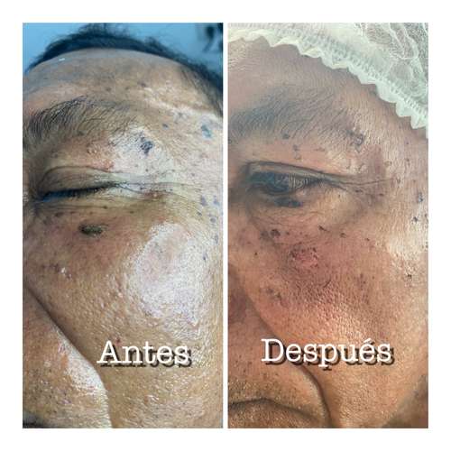 Tratamiento faciales específico 