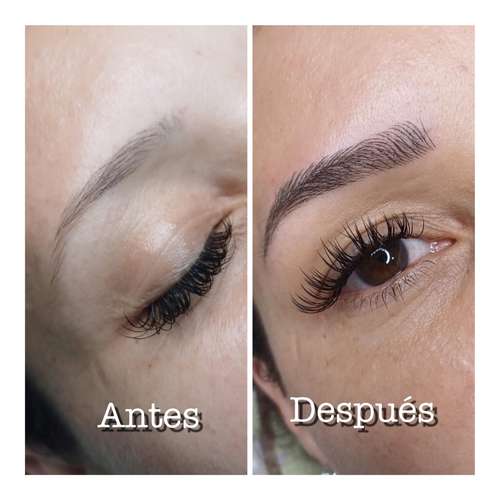 Tratamiento faciales específico 